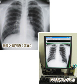 胸部X線写真(正面)